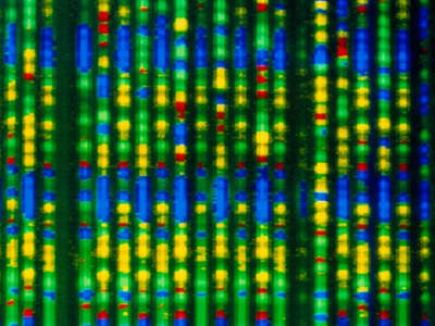 Terapi Gen Base Editing: Harapan Baru untuk Penyakit Gen Langka Anak