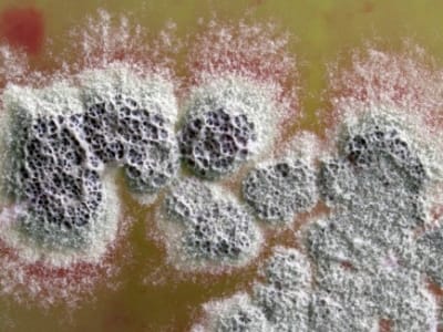 Penemuan Antibiotik Baru 100 Kali Lebih Kuat dari Obat Lama oleh Bakteri Tanah