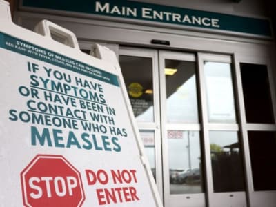 Lonjakan Kasus Campak Biarkan Kanada Kehilangan Status Bebas Campak