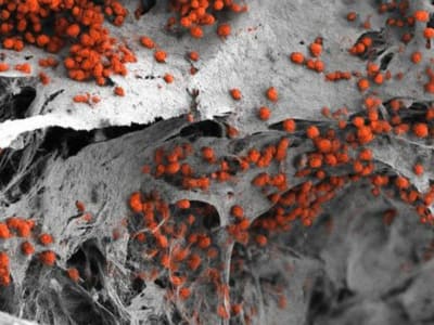 Model Sumsum Tulang Manusia Pertama dengan Sel Asli untuk Obat dan Kanker