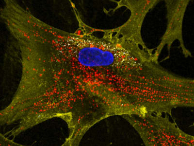 Metode Baru Nanopartikel Dorong Sel Punca Produksi Mitokondria Ganda