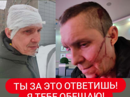 Жителю Липецка сломали челюсть в ночном клубе: его жена просит помощи в поиске нападавшего