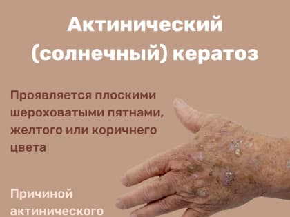 ВИДЫ КЕРАТОЗА