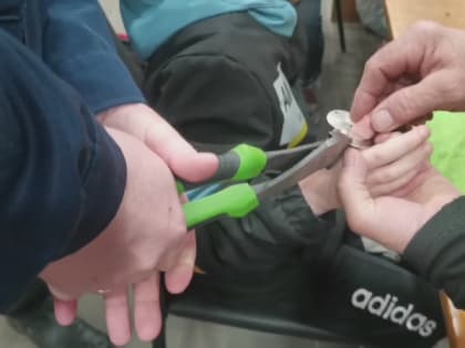 Спасатели оказывали помощь ребенку, палец которого застрял в дверном глазке