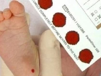 Расширенный неонатальный скрининг новорожденных