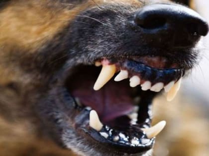 В Краснодарском крае 4-летнего ребенка за лицо укусила собака