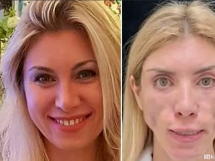 Цена врачебной ошибки