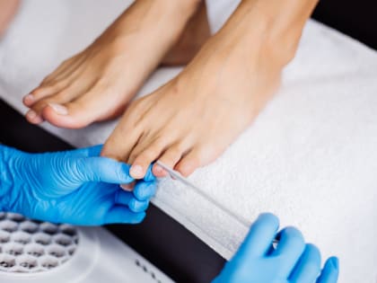 Победить грибок: всего один ингредиент и от онихомикоза не останется следа