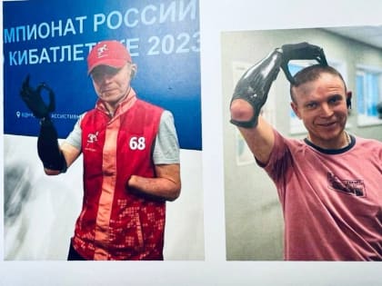 Во Всеволожске планируют строительство центра протезирования и реабилитации