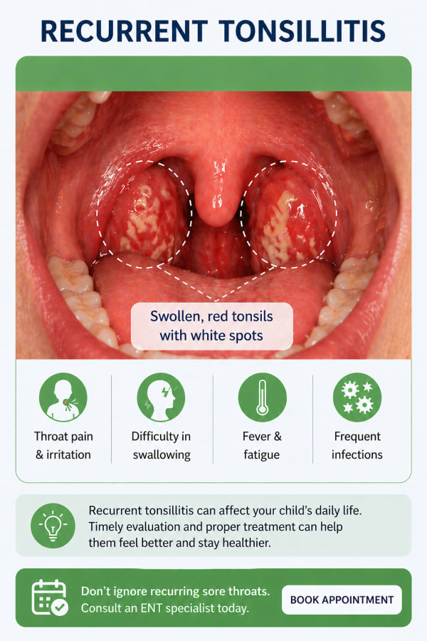 Tonsillectomy FAQ - tonsil surgery questions answered - HealthNest Clinic Lucknow Dr Akansha Tewari