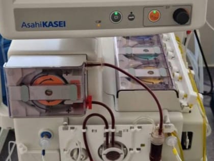 Успехи селективной плазмосорбции в лечении печеночной недостаточности