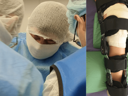 Первое выполнение артроскопической пластики передней крестообразной связки в детской клинической больнице