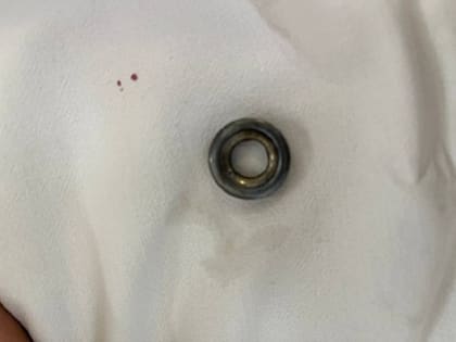 В Саратове 9-летний мальчик проглотил деталь от игрушки