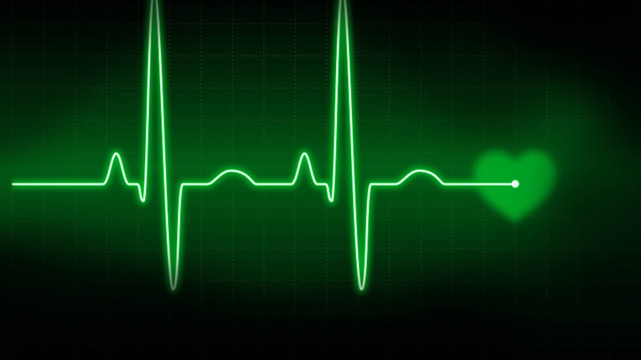 Усилилось сердцебиение. Ритмы сердца на ЭКГ. Кардиограмма серлце. Картодиаграмма сердца. Линия пульса.