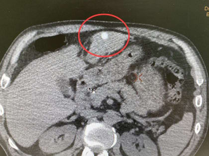 Талдомские врачи спасли мужчину с 7 пулевыми ранениями