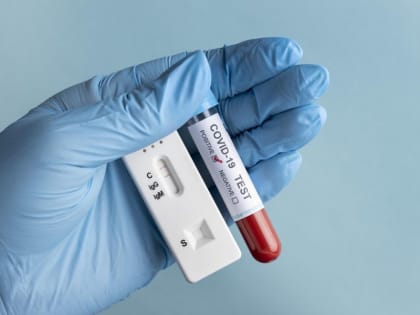 Онищенко пояснил, стоит ли переживать из-за роста заболеваемости коронавирусом