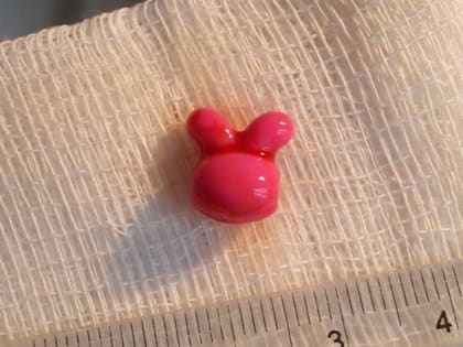 Подмосковные медики спасли двух детей, засунувших в носы часть игрушки и орех