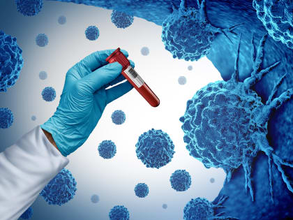 США приостановили исследования нового метода лечения рака в России