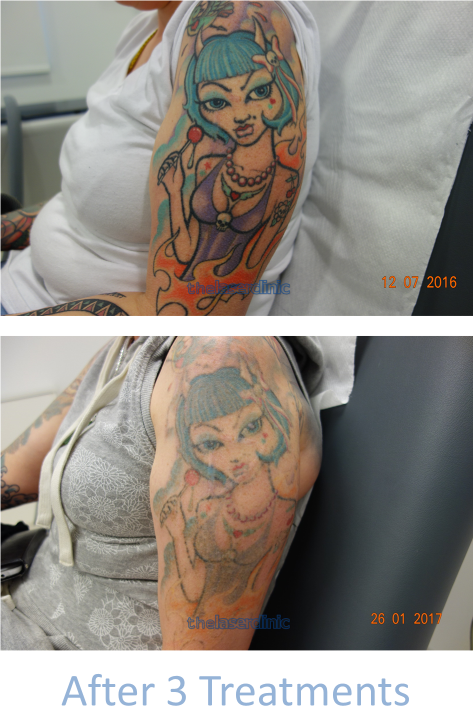 Fading This Brightly Coloured Tattoo Required Only - Color Tattoo Photos Download, HD Png Download - Transparent PNG Free Download