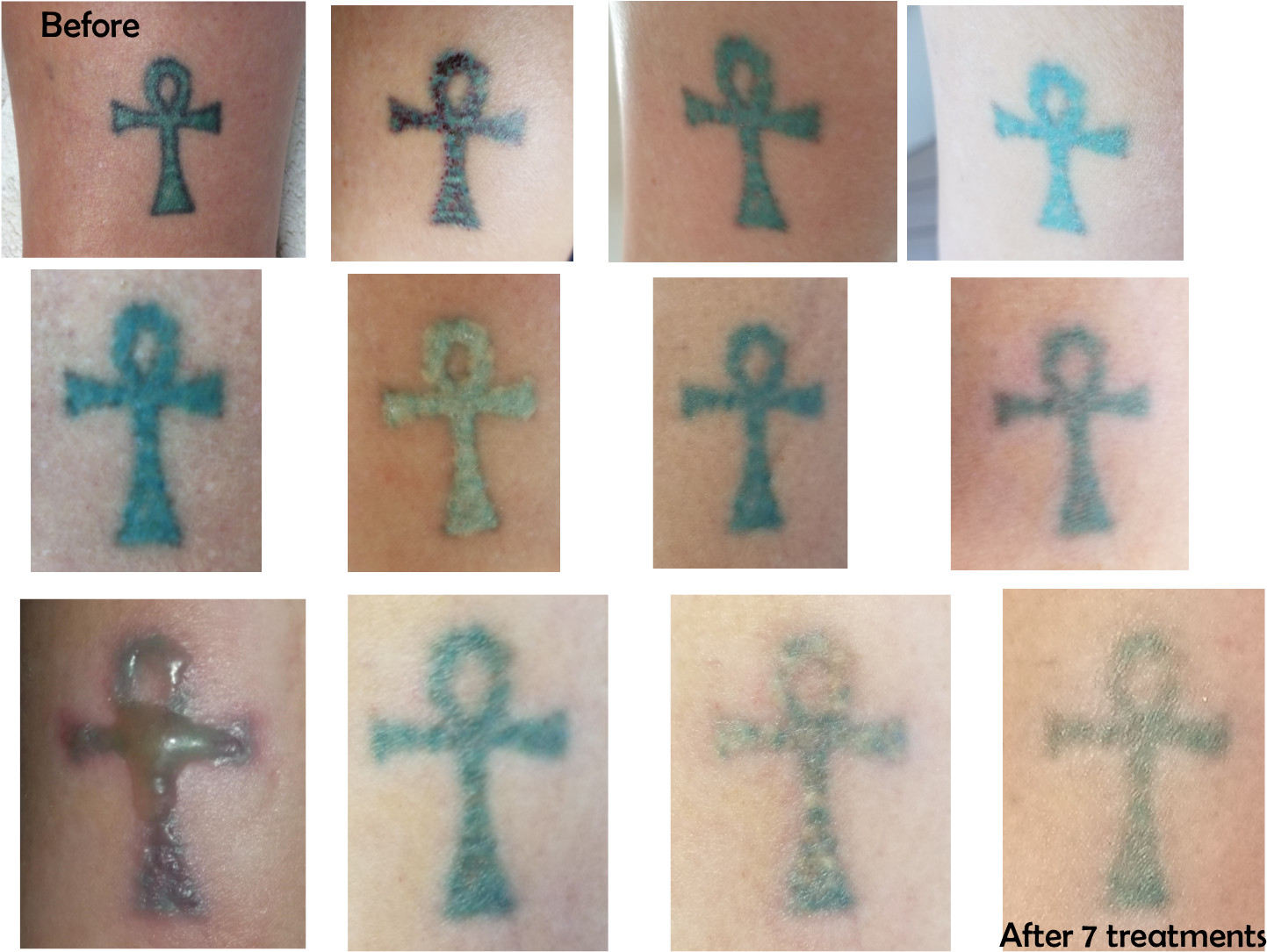 Cross, HD Png Download - Transparent PNG Free Download