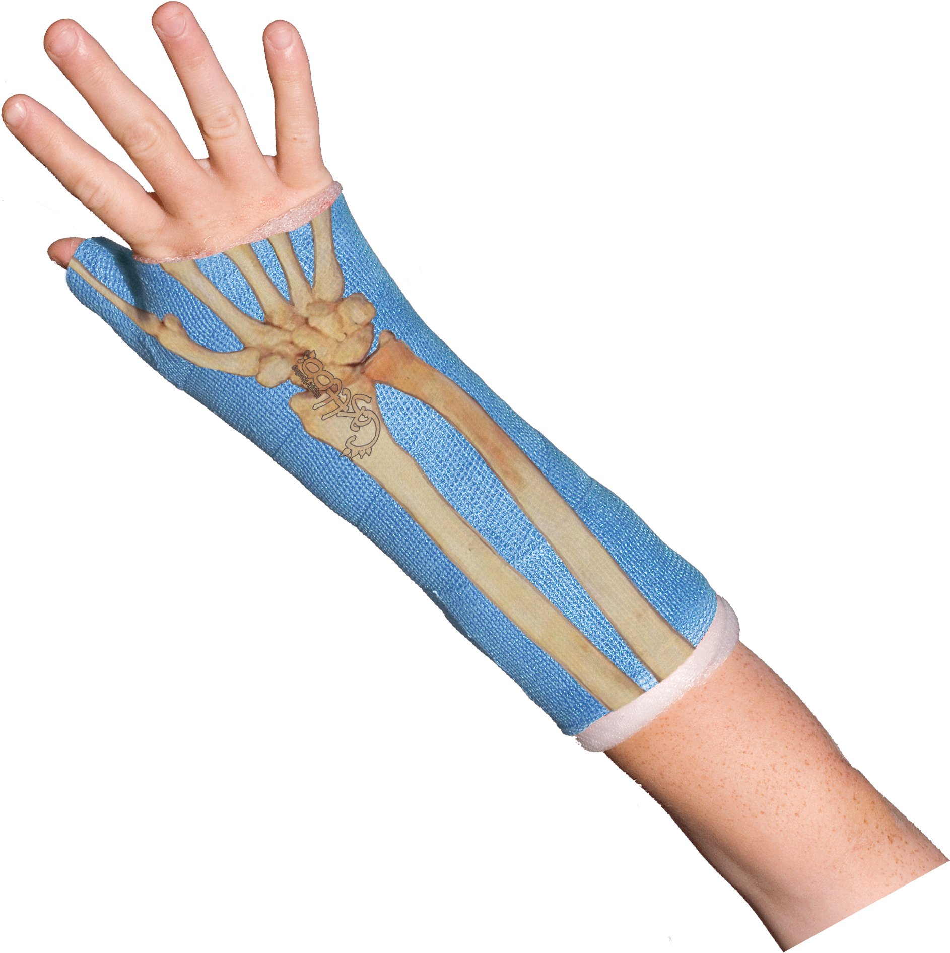 Bones Wrist Bones Casttoo Orthopedic Cast Tattoos Gif - Orthopedic Cast, HD Png Download - Transparent PNG Free Download