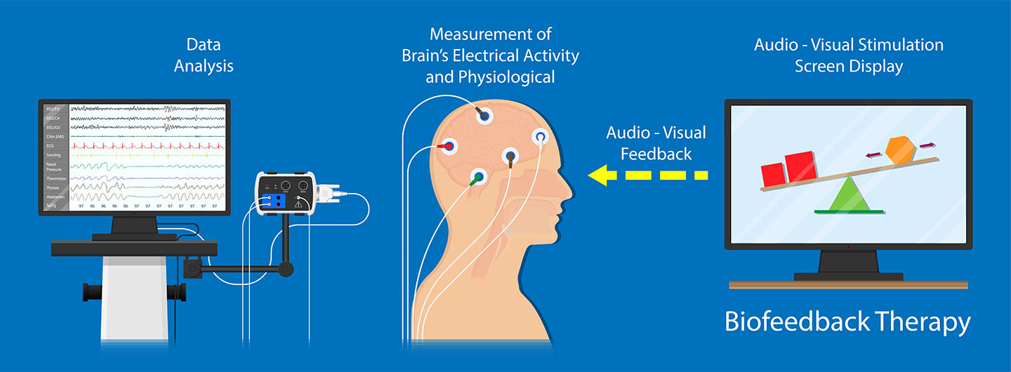 Biofeedback Therapy infographic: data analysis on the left (EEG/ECG/respiration waveforms feeding into an amplifier), brain electrical activity measurement in the center (head profile with EEG electrodes), and an audio-visual stimulation screen on the right. A dashed feedback arrow loops from the screen back to the patient, showing how the brain learns to shift toward healthier patterns.