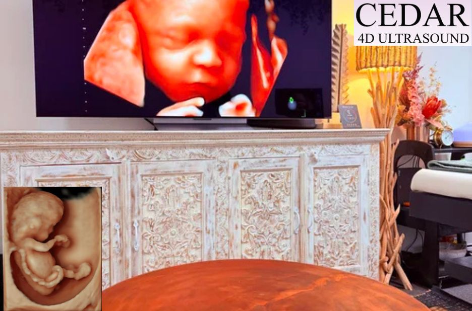 Ultrasound Near Me: Clear Imaging and Easy Booking in Perth