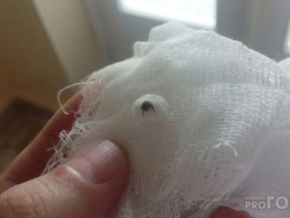 В Нижегородской области обнаружили клещей с энцефалитом