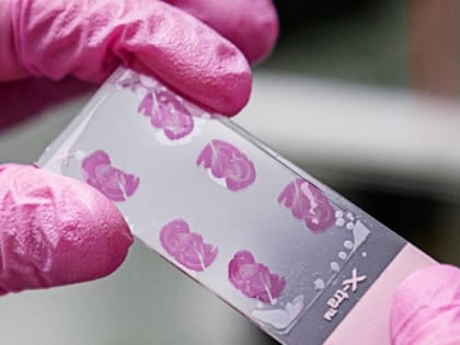 Нижегородские ученые усовершенствовали технологию восстановления клеток мозга