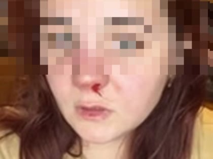 Соцсети: нижегородец сломал нос девушке в лифте