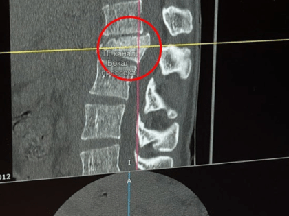Чудо выживания: молодой человек выжил после падения с седьмого этажа