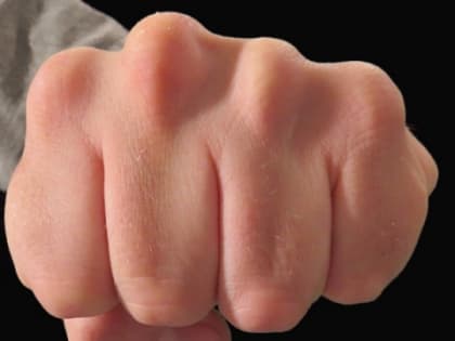 Родственник пациента избил фельдшера СМП в Дальнеконстантиновском районе