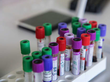 Нижегородские ученые представили новую систему биомаркеров старения