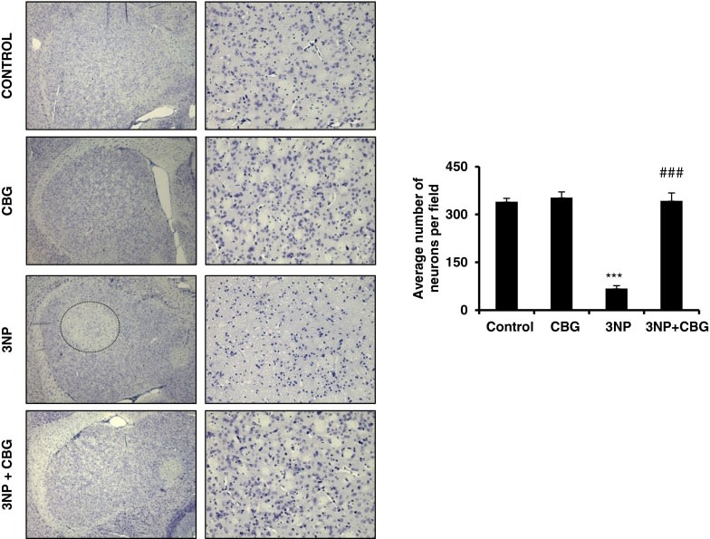 CBG a Huntingtonova choroba - účinky kanabigerol u na degeneraci neuronů
