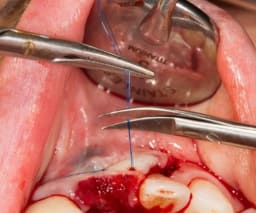 IÂ´Motion, Micro-Nadelhalter, 18 cm, Hartmetall, gerade