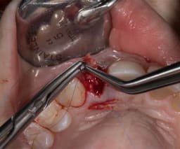 IÂ´Motion, Micro-Nadelhalter, 18 cm, Hartmetall, gerade