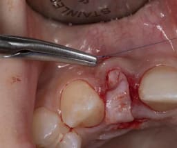 IÂ´Motion, Micro-Nadelhalter, 18 cm, Hartmetall, gerade