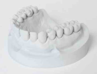Dentona Hydro-Stone 200 Parelgrijs 25 kg