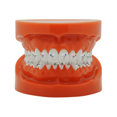 Ceramic SL Selbstligierend (Roth)