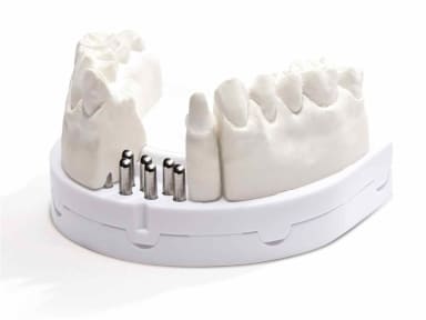 Dentona Opti-Basis Klein Excl. Manchet (4 stuks)