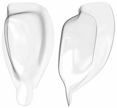 American Dental Systems Bioclear Matr. Diastema DC202-50 (50 stuks)