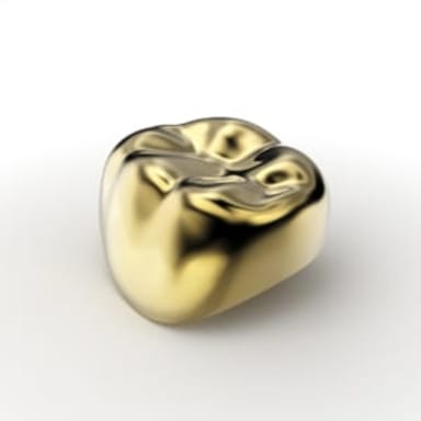 SHINHUNG Complete set of steel crowns for the first and second primary molars – 5 pieces, Size: 2, Tooth: 54, Color: Gold