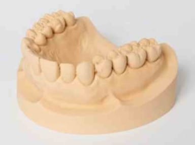 Dentona Zero-Stone Goudbruin 5 kg