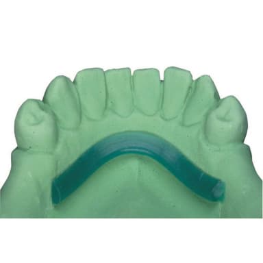 al dente Dentalprodukte Mandibulaire Beugel 4,0 x 2,0 mm 65 g