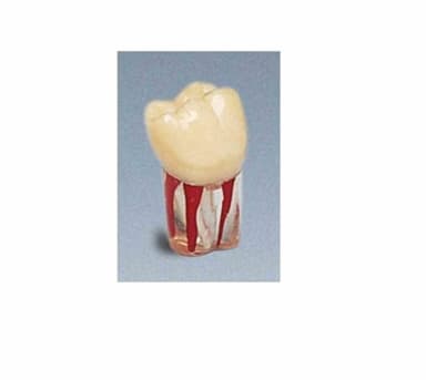 Frasaco Model tand UK 46 Wuka met Schroef