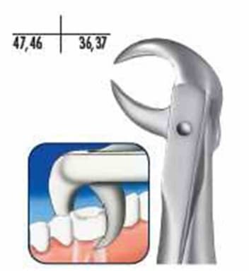 Zahnzange L.S. 86C UK Molar