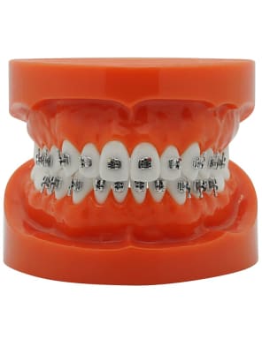 Laser Mini Bracket (MBT)