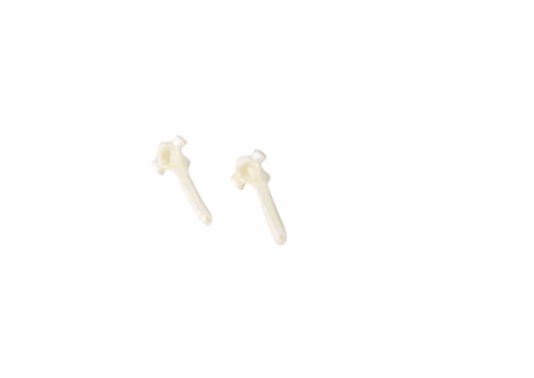 MK-Vario UK Molar H mittel rechts 25St