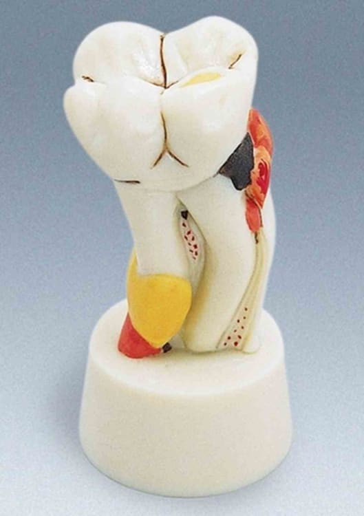 Frasaco Modell D-15 Molar