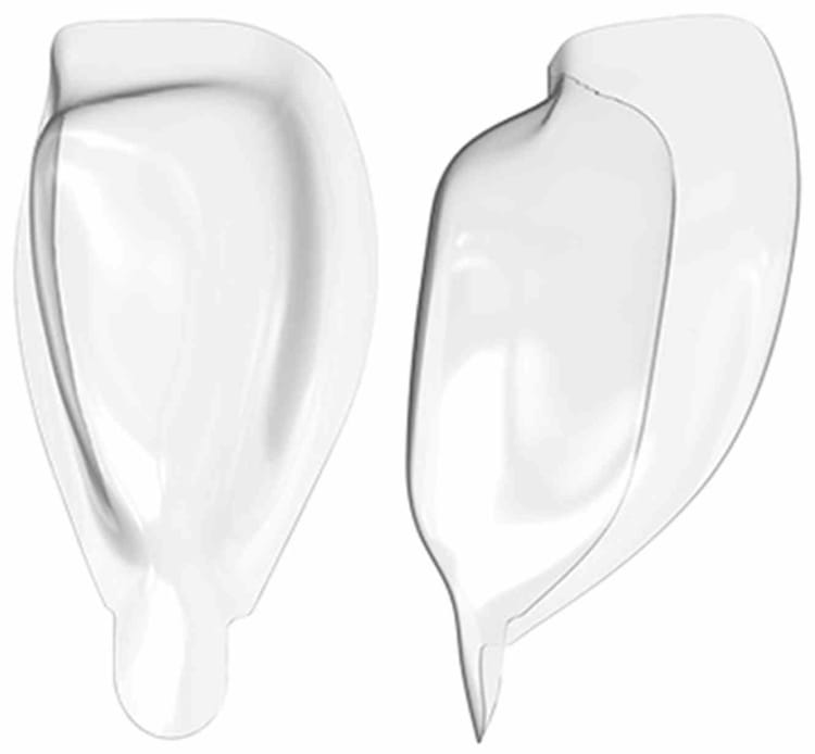 Bioclear Matr. Diastema DC203-50 50St